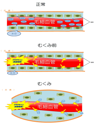 HAEによるむくみのイメージ図